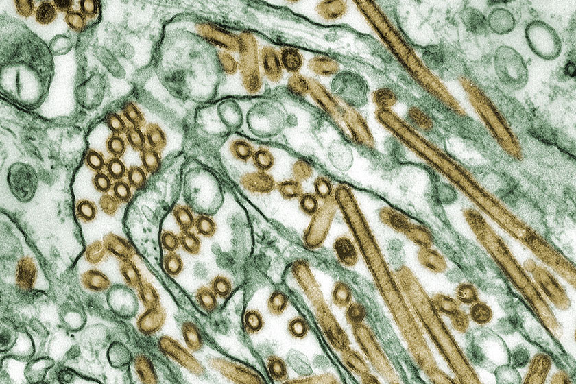 Avian influenza A (H5N1) viruses (Bird Flu) as I imagine they would look like in my snot