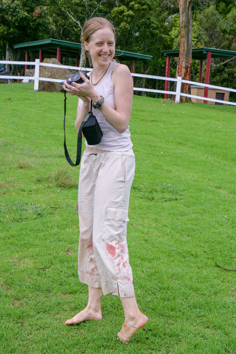 Bronwen suffering from leeches, Coomera Circuit, Lamington National Park